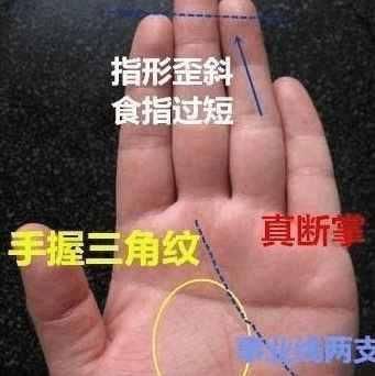 两手都断掌女人命运_女人断掌_男人断掌黄金万两女人断掌