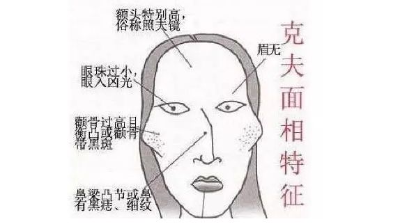 人中面相图解_鼻头压人中 面相_人中面相