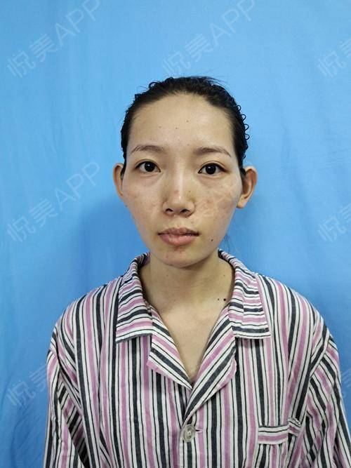 女人颧骨高真的克夫吗_女人颧骨高真的克夫吗?_颧骨高克夫