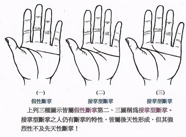 手相图解女人断掌纹_断手纹和断掌纹一样吗_断掌纹的女人