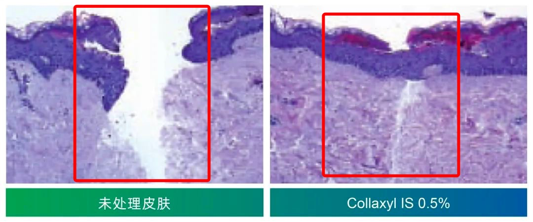 抬头纹太深_抬头纹很深怎么办_抬头纹开了