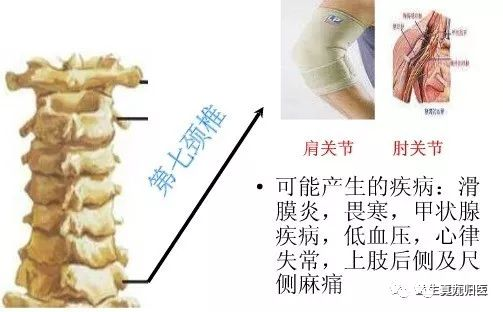 手掌内脏对应图女_手掌内脏对应图_手掌对应内脏